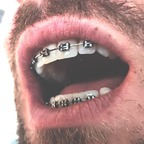 braces avatar